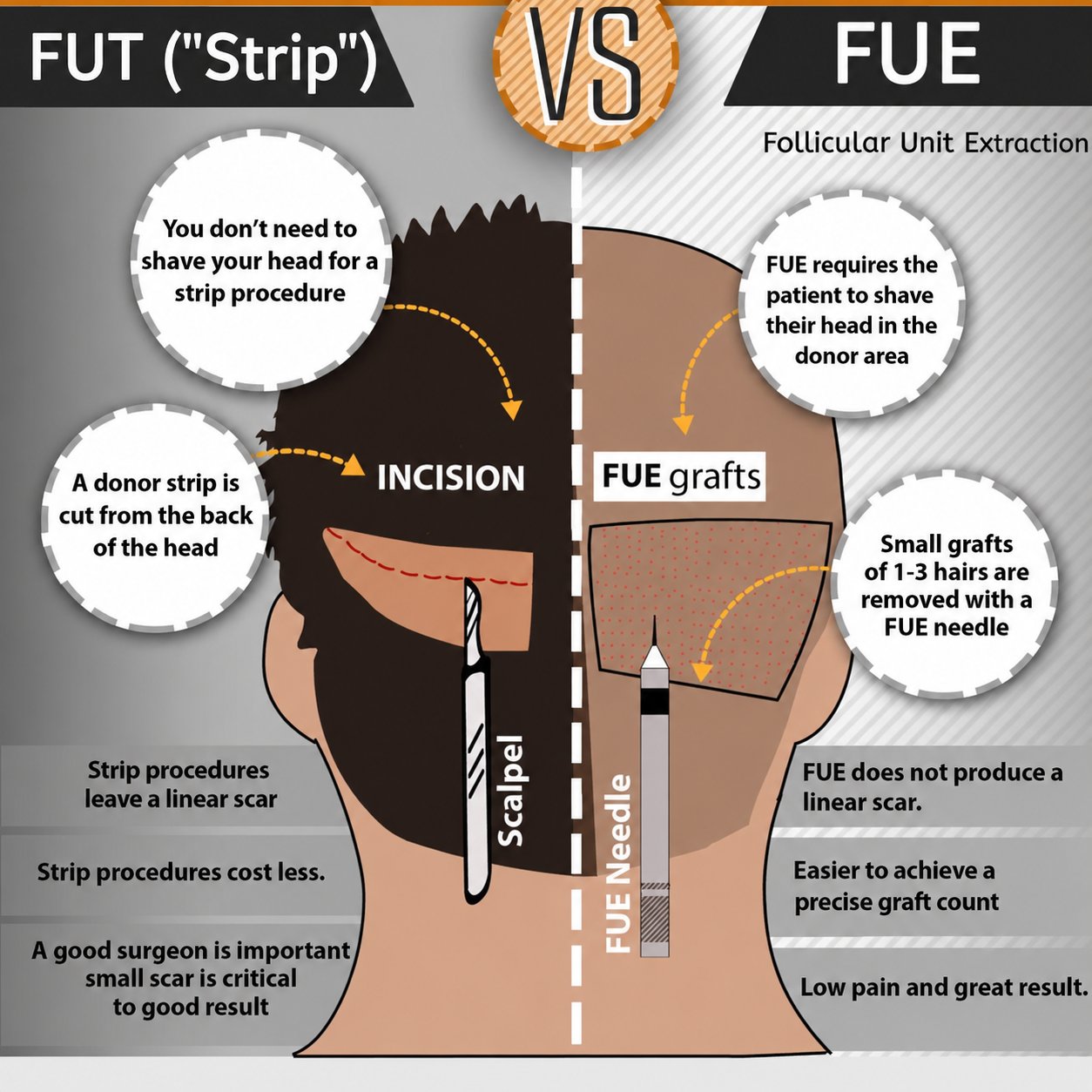 FUT vs FUE comparison diagram
